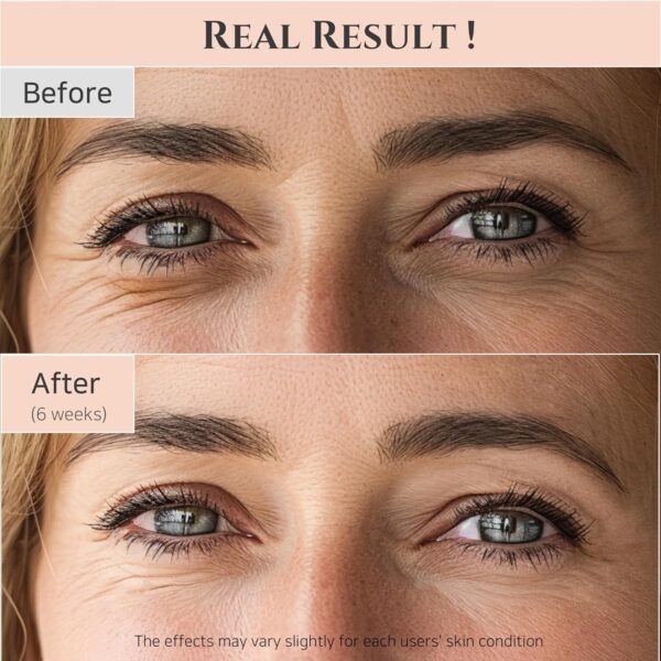 Beauty of Joseon Revive Eye Serum with Ginseng & Retinal (30m) | Anti-Aging, Wrinkle Care, Korean - Image 4